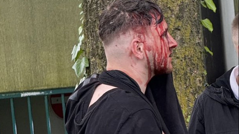 Euro 2024: Ξύλο ανάμεσα σε Άγγλους και Σέρβους χούλιγκαν – Αναφορές και για εμπλοκή Αλβανών