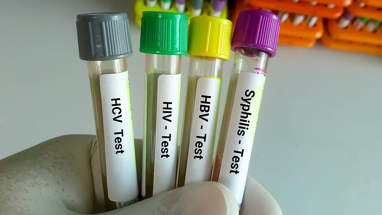 Ποιοι είναι οι κίνδυνοι μόλυνσης από σεξουαλικώς μεταδιδόμενα νοσήματα μέσω του στοματικού σεξ;