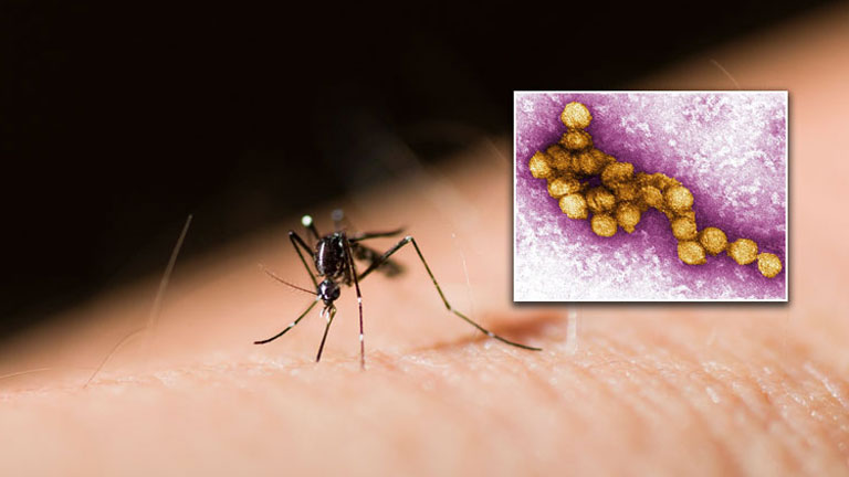 Στη Λάρισα το πρώτο κρούσμα λοίμωξης από τον ιό του Δυτικού Νείλου