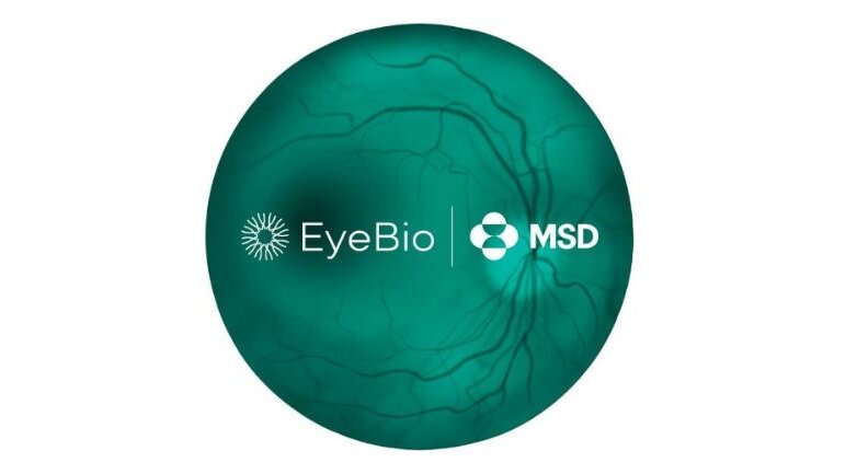 Η MSD μέσω θυγατρικής εταιρείας ανακοίνωσε την εξαγορά της EyeBio