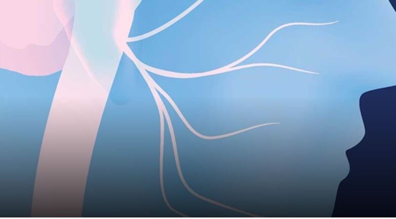 Αποκατάσταση παράλυσης προσωπικού νεύρου