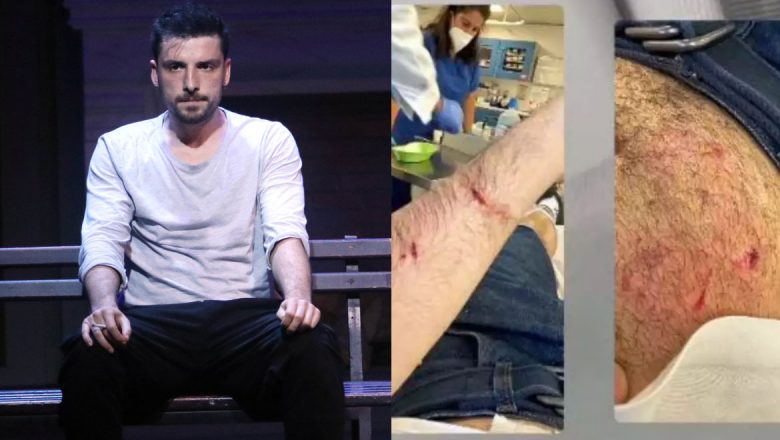 Στο νοσοκομείο ο ηθοποιός Σπύρος Χατζηαγγελάκης μετά από επίθεση που δέχτηκε από σκύλο