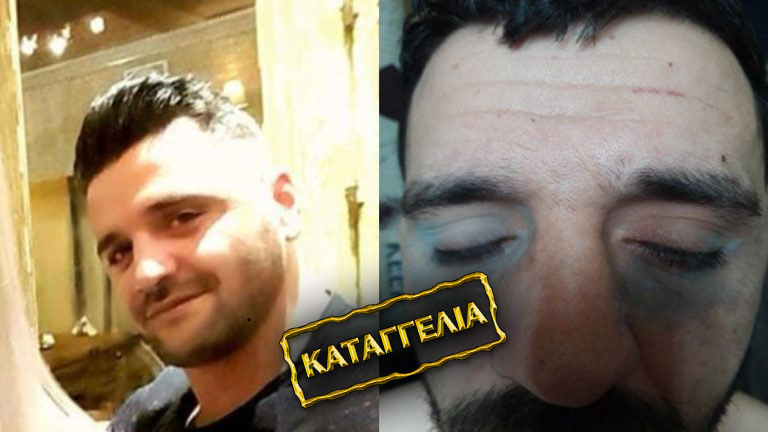 Καταγγελία: Θύμα βασανισμού από αστυνομικούς μιλάει στη «Ζούγκλα» και ζητάει δικαίωση – «Να λάμψει η αλήθεια…»