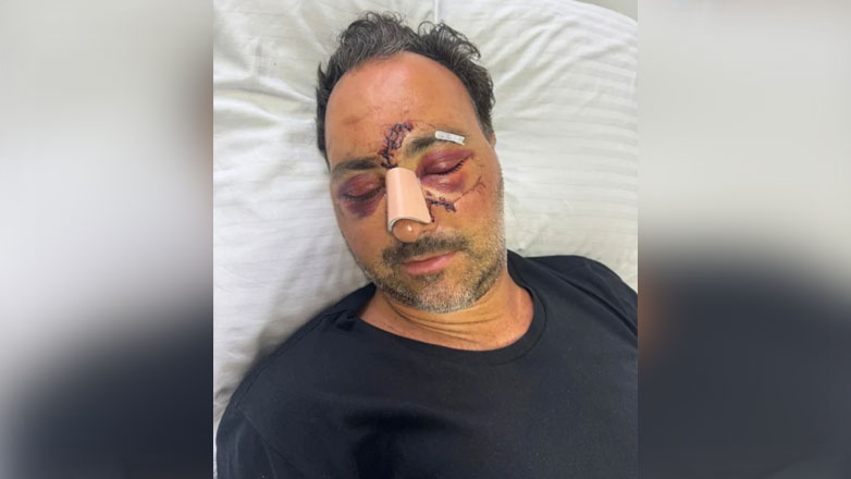 «Είναι άβατο ακόμα και για τα ΕΚΑΜ η Κρήτη» – Άφαντοι οι δράστες που ξυλοκόπησαν τον Ελληνοκαναδό τουρίστα