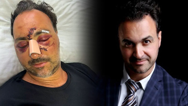 Εξιτήριο για τον Ελληνοκαναδό μετά από 14 ημέρες