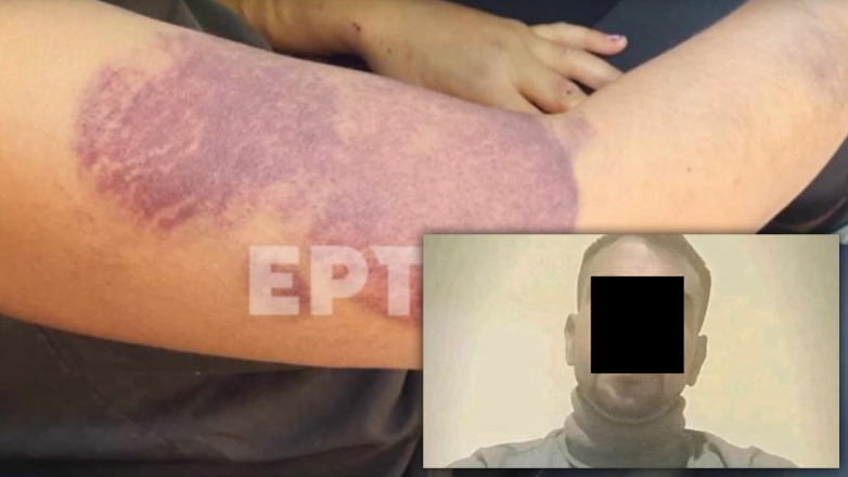 Ντοκουμέντο: Η κυνική ομολογία του 32χρονου για την κακοποίηση της συντρόφου του