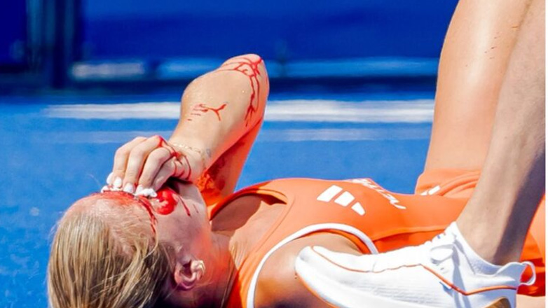 Παρίσι 2024: Σοκαριστικός τραυματισμός στον ημιτελικό γυναικών του χόκεϊ