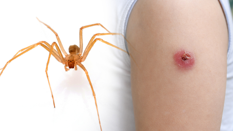Τι είναι η καφέ αράχνη – ερημίτης και γιατί δεν υπάρχει αντίδοτο Τι είναι η καφέ αράχνη – ερημίτης και γιατί δεν υπάρχει αντίδοτο