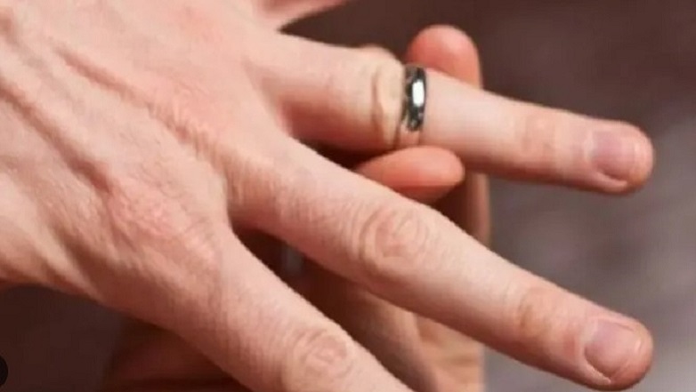 Γιατροί έψαχναν βίντεο στο Youtube για να αφαιρέσουν δαχτυλίδι από χέρι ασθενούς