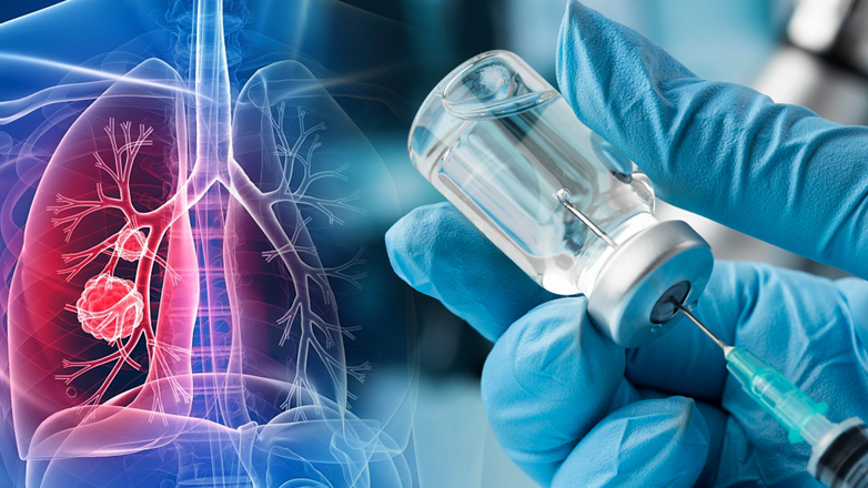 Ιστορικό επίτευγμα: Άρχισαν οι δοκιμές του εμβολίου για τον καρκίνο του πνεύμονα