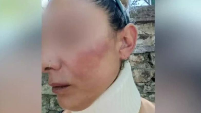 Λέσβος: Συνελήφθη ο 36χρονος πυροσβέστης που ξυλοκόπησε την σύζυγό του και την έστειλε στο νοσοκομείο