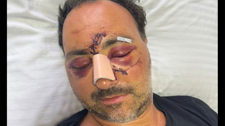 Ηράκλειο: Ελεύθερος αφέθηκε ο τρίτος κατηγορούμενος για τον ξυλοδαρμό του Ελληνοκαναδού επιχειρηματία