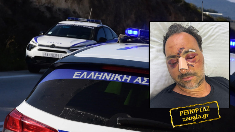 «Με χτυπούσαν από παντού»