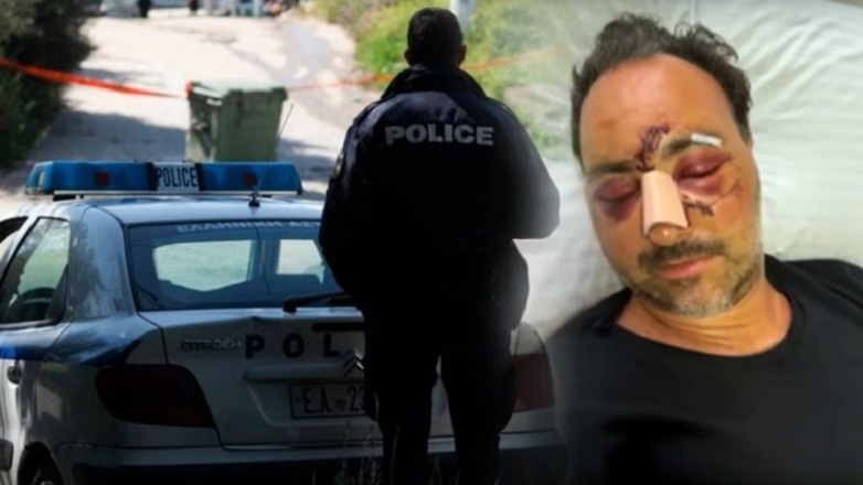 Στον εισαγγελέα οι δράστες για τον ξυλοδαρμό του Ελληνοκαναδού