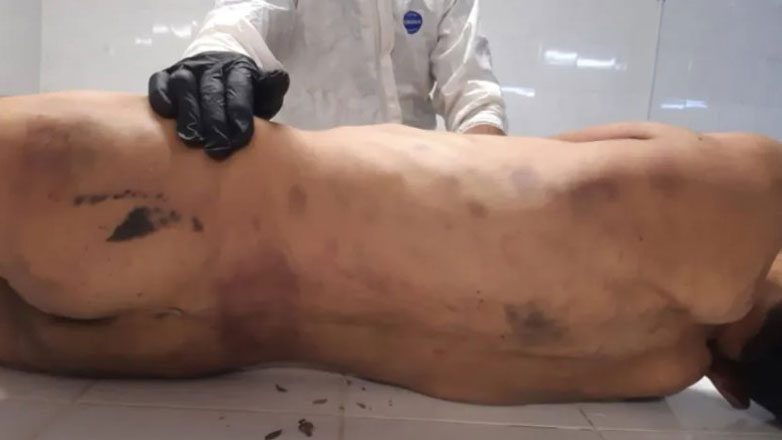 Χρυσοχοΐδης για τον θάνατο κρατουμένου στο ΑΤ Αγ. Παντελεήμονα: Να μην υπάρξει η παραμικρή υποψία για συγκάλυψη