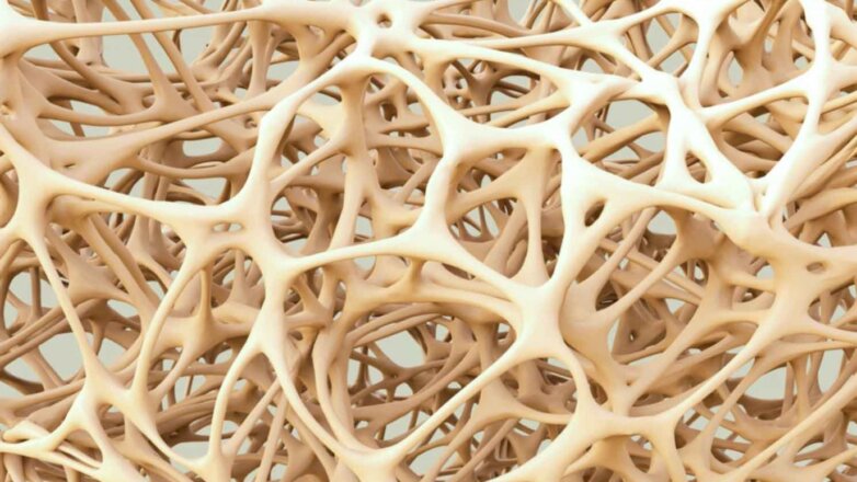 Οστεοπόρωση: Ό,τι χρειάζεται να γνωρίζετε