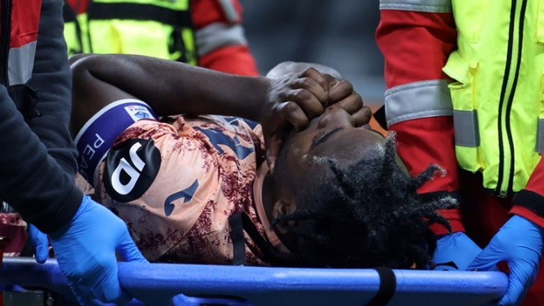 Τορίνο: Τέλος η σεζόν για τον Ζαπάτα