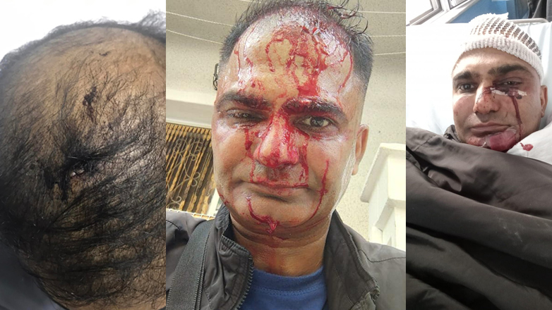 Άγριος ξυλοδαρμός ντελιβερά από 3 αγνώστους