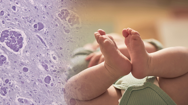 Τραγωδία στον Βόλο: Παιδάκι 22 μηνών εξέπνευσε από σπάνιο σύνδρομο