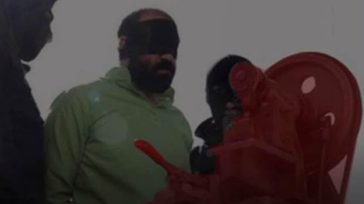 Η Τεχεράνη ακρωτηρίασε τα δάχτυλα σε δύο άνδρες που είχαν καταδικαστεί για κλοπή