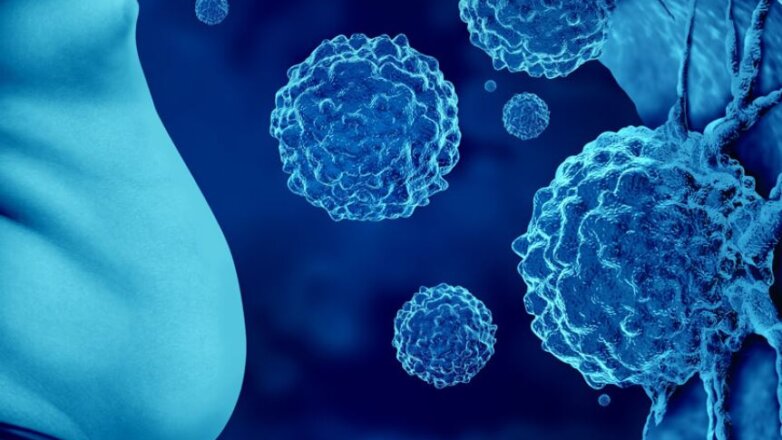 Παχυσαρκία: Πώς συνδέεται με τον καρκίνο;