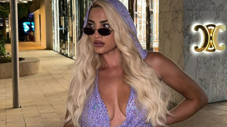 Ιωάννα Τούνη: Ατύχημα για την γνωστή influencer – «Κάηκα μόνη μου και τώρα βάζω αναπλαστική»