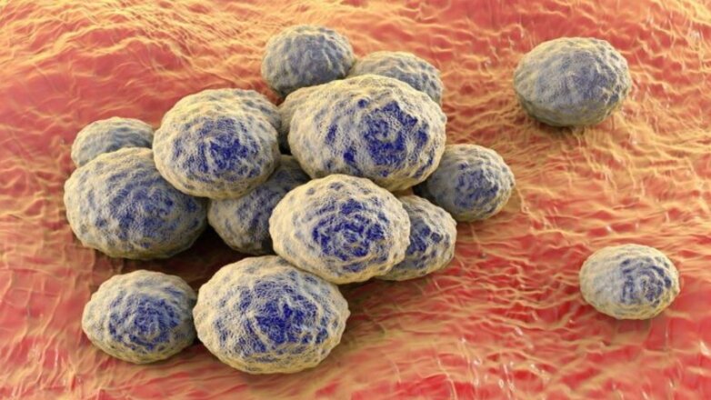 Τι είναι ο χρυσίζων σταφυλόκοκκος Τι είναι ο χρυσίζων σταφυλόκοκκος