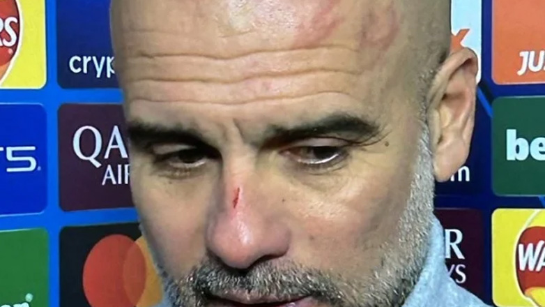 Mε αμυχές στο πρόσωπο o Γκουαρντιόλα: «Ήθελα να βλάψω τον εαυτό μου»