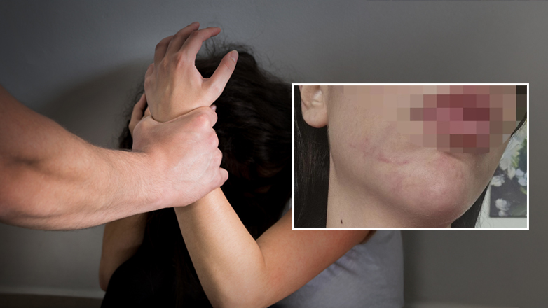 Τριήμερος εφιάλτης για νεαρή εκπαιδευτικό στα χέρια του συντρόφου της