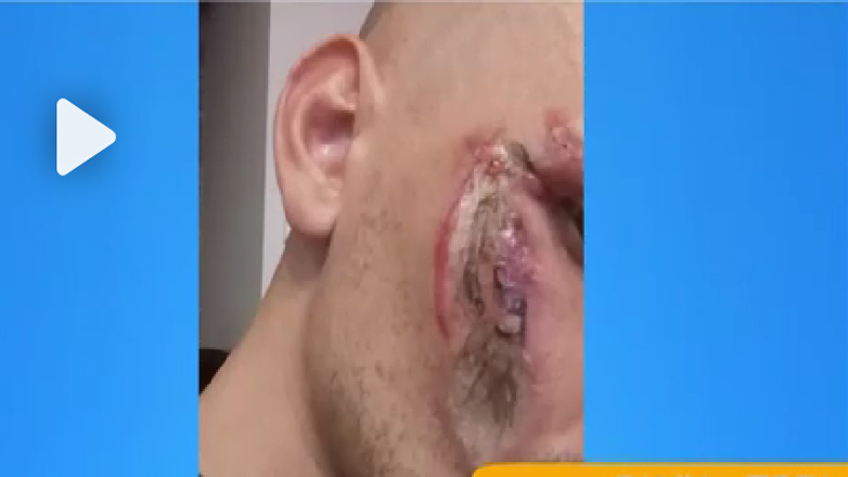 Κινητό τηλέφωνο «έσκασε» την ώρα που κοιμόταν ο ιδιοκτήτης του