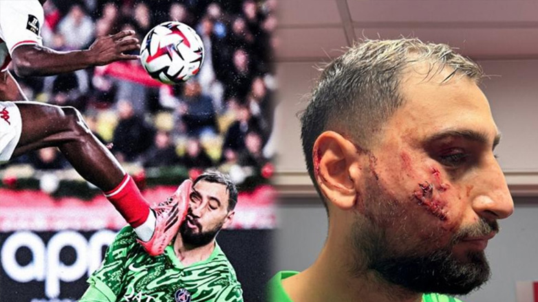 Ζήτησε συγγνώμη ο Σινγκό από τον Ντοναρούμα: «Δεν ήταν σκόπιμο, καλή ανάρρωση»