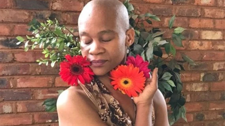 Πέθανε σε ηλικία 39 ετών η διάσημη νοτιοαφρικανή χορεύτρια Ντάντα Μασιλό