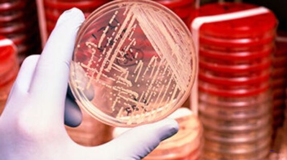 Η μικροβιακή αντοχή είναι πιο εκτεταμένη από όσο γνωρίζουμε