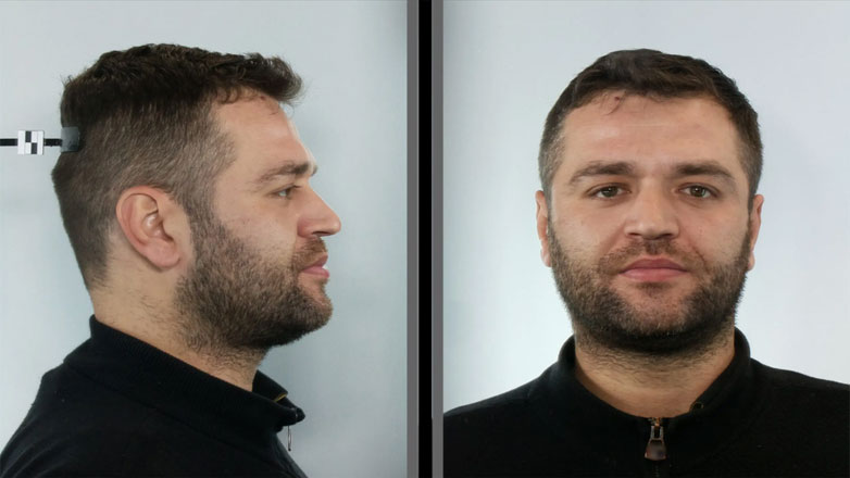 Στη δημοσιότητα τα στοιχεία 36χρονου που συνελήφθη για κλοπές πορτοφολιών από επιβάτες συρμού Τραμ