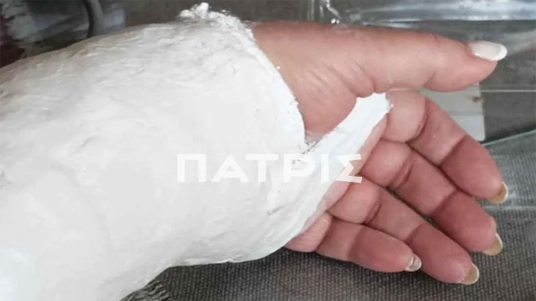 Τραυματίστηκε 65χρονη από επικίνδυνες σχάρες ομβρίων στο κέντρο του Ηρακλείου