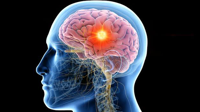 Τι πρέπει να ξέρετε για τις επιληψίες και το ηλεκτροεγκεφαλογράφημα