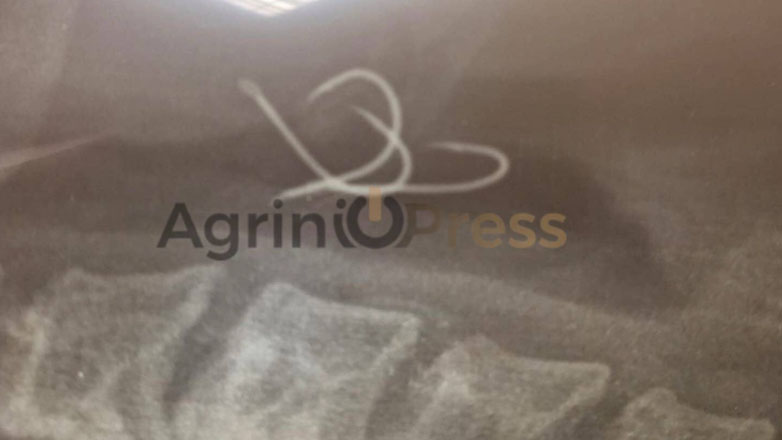 Έφαγε χταπόδι και του κόλλησε στο λαιμό… αγκίστρι