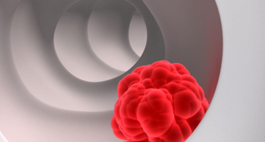 Ο ρόλος της τεχνητής νοημοσύνης στην κολονοσκόπηση