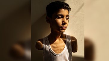 Η φωτογραφία του έτους από το World Press Photo: Ο 9χρονος ακρωτηριασμένος Παλαιστίνιος