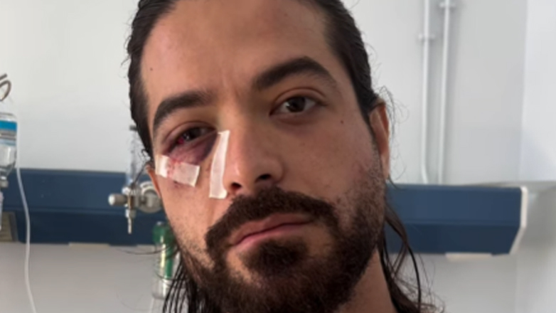 Η πρώτη ανάρτηση του Άρη Μουγκοπέτρου μετά τον ακρωτηριασμό του: « Νόμιζα ότι ήταν καπνογόνο και την πάτησα σαν πανίβλακας»