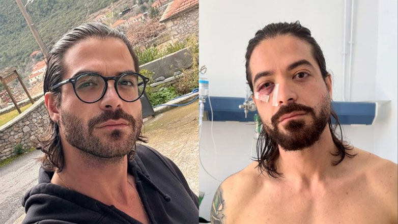 Άρης Μουγκοπέτρος: Τα πρώτα λόγια του μουσικού μέσα από το νοσοκομείο – «Έχασα ό,τι πιο πολύτιμο είχα αυτή τη στιγμή»