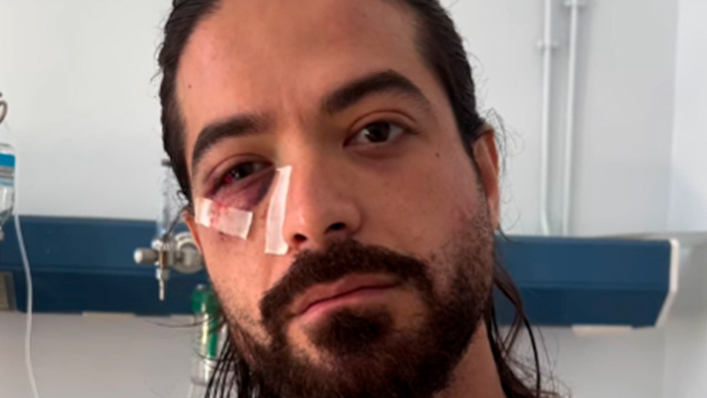 Η ανάρτηση του Άρη Μουγκοπέτρου μέσα από το Νοσοκομείο: «Νόμιζα ότι ήταν καπνογόνο και την πάτησα σαν πανίβλακας»