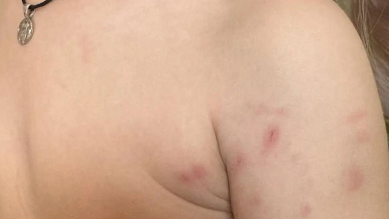 Αιτωλικό: Σκύλος επιτέθηκε σε ανήλικο