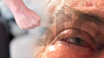 Γλυφάδα: Παρέσυραν επιχειρηματία στο πατάρι εστιατορίου, που δεν είχε κάμερες και τον ξυλοκόπησαν