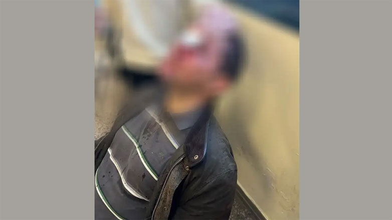 Βίντεο με τους δράστες της επίθεσης στη Νομική εξετάζει η αστυνομία Βίντεο με τους δράστες της επίθεσης στη Νομική εξετάζει η αστυνομία