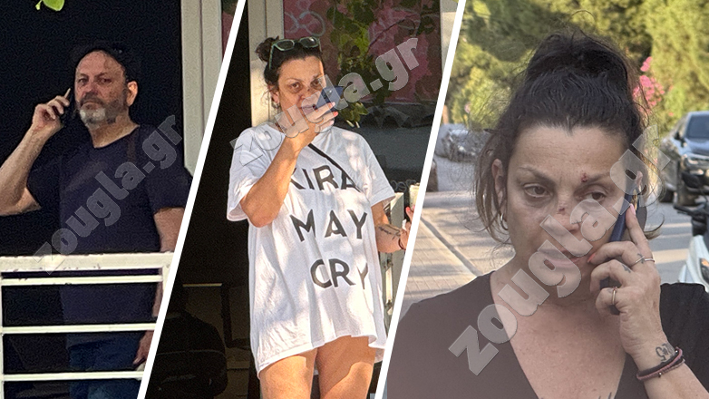 Τα σημάδια στο πρόσωπο της πρώην συζύγου του Στάθη Αγγελόπουλου