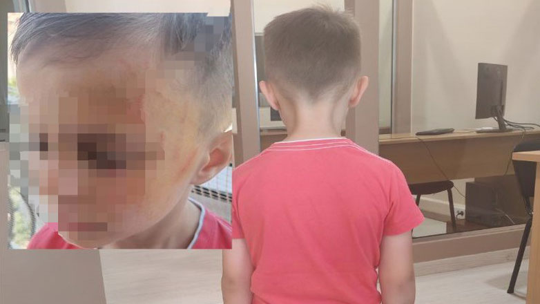 Έδειραν 5χρονο σε… νηπιαγωγείο του Αγρινίου