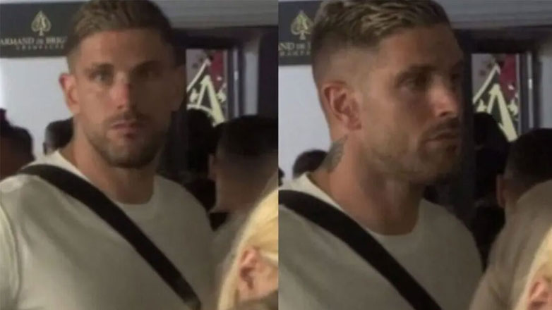 Αλέξανδρος Πασχαλάκης: Τα σημάδια στο πρόσωπό του μετά τον άγριο καβγά στη Μύκονο – Βίντεο