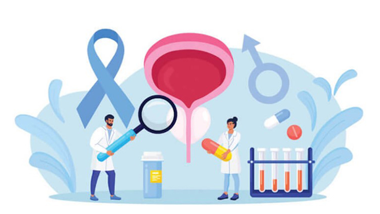 Καρκίνος του προστάτη: Όλες οι απαντήσεις στα πιο συχνά ανδρικά ερωτήματα