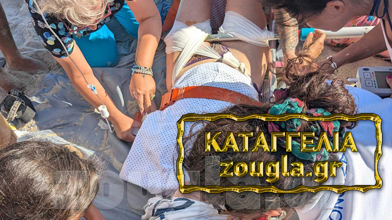 Καταγγελία στη «Ζούγκλα»: Ομπρέλα παραλίας καρφώθηκε στο πόδι κοπέλας